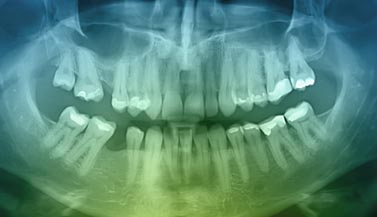 XRay thumbnail banner